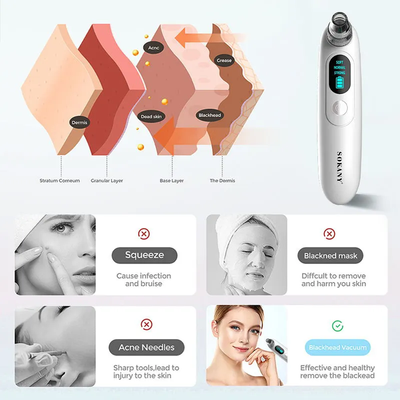 Beauty Equipment Wholesalers Blackhead Remover Wholesale - SOKANY 6