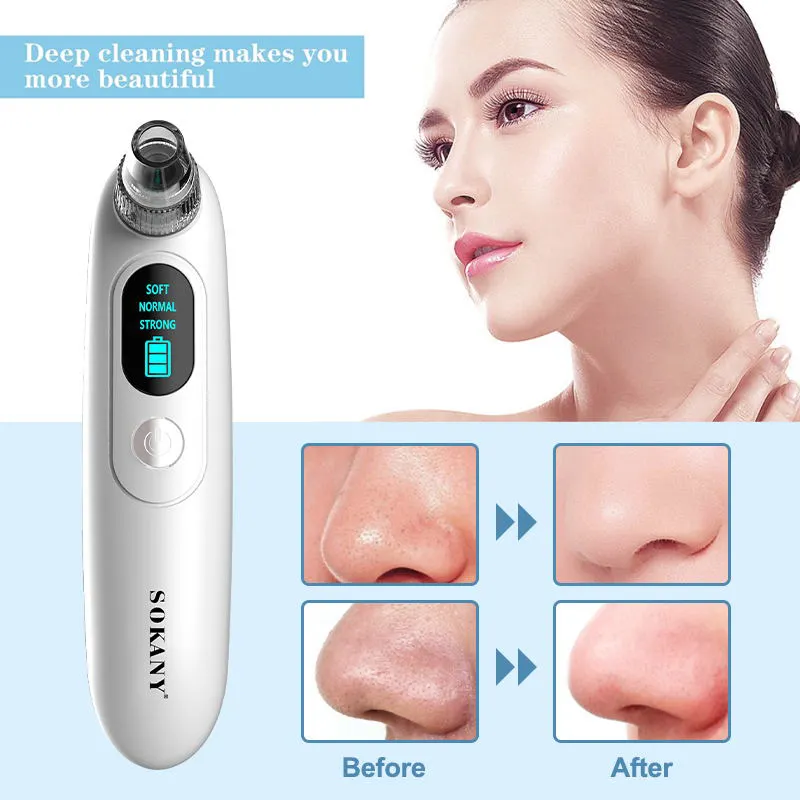 Beauty Equipment Wholesalers Blackhead Remover Wholesale - SOKANY 3