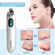 Beauty Equipment Wholesalers Blackhead Remover Wholesale - SOKANY 3